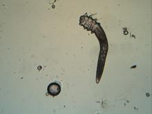 Demodex folliculorum