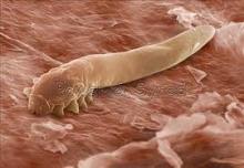 demodex atka elektronmikroszkóp alatt